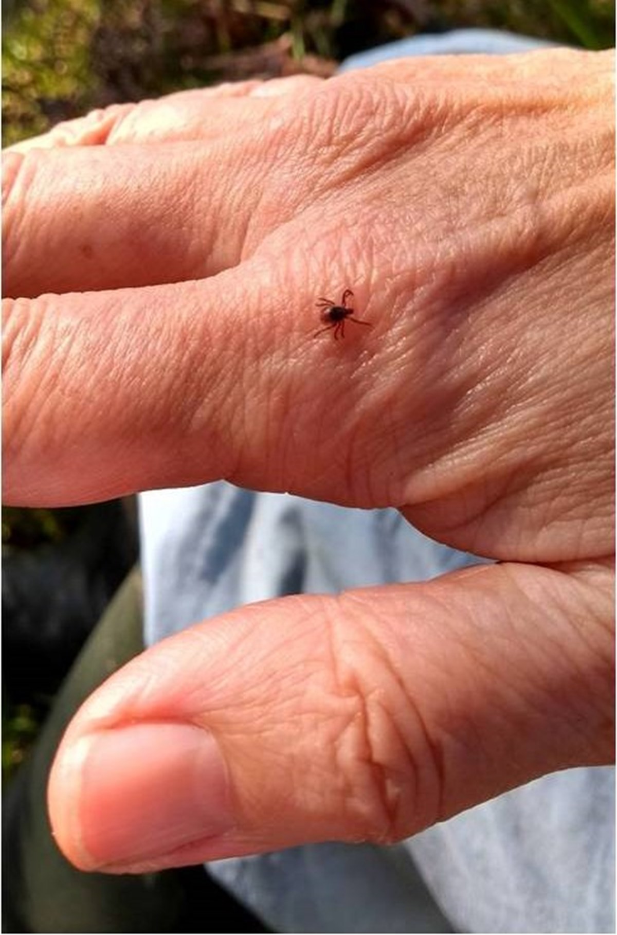 Tick On A Hand